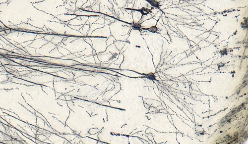 �ߠ���Ⱦɫ�����裩