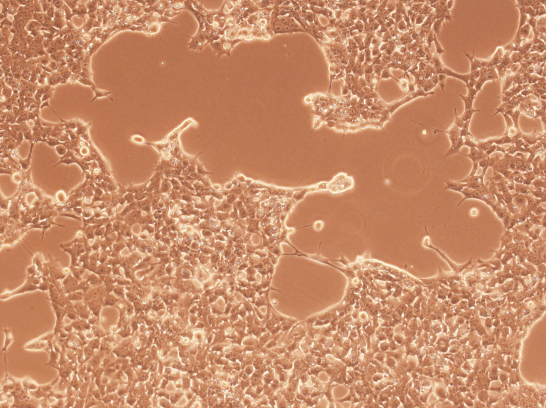 �����ٰ�������MDA-MB-175